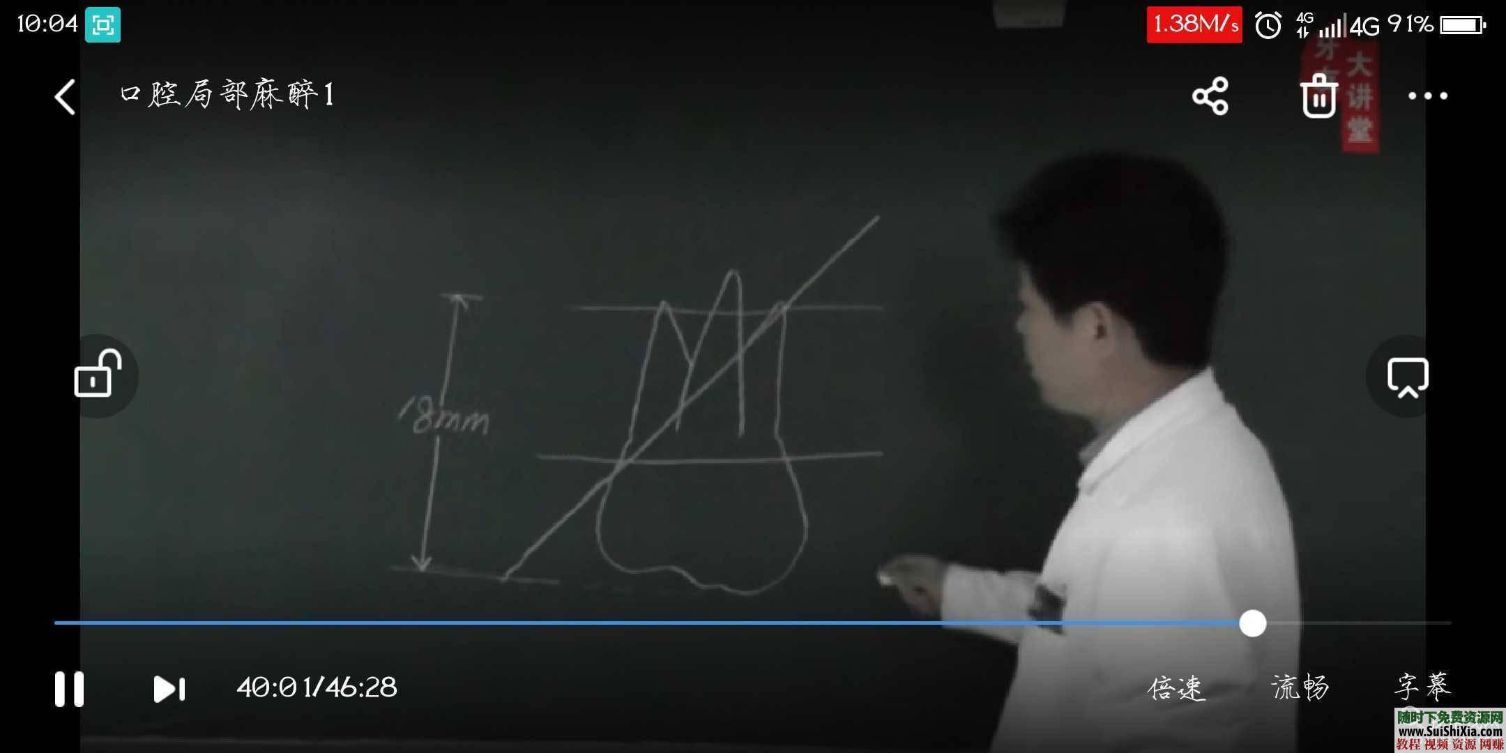 零基础教学初级视频阻滞浸润操作理论口腔局部麻醉教学课程视频  口腔局部麻醉教学课程视频零基础教学初级视频阻滞浸润操作理论 第3张