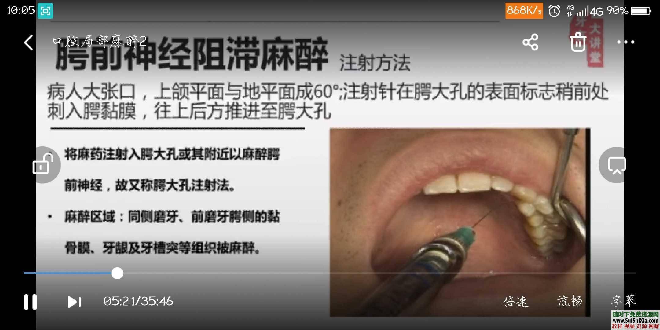 零基础教学初级视频阻滞浸润操作理论口腔局部麻醉教学课程视频  口腔局部麻醉教学课程视频零基础教学初级视频阻滞浸润操作理论 第9张