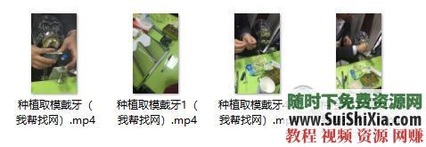 口腔种植 种植资料+种植杂志PDF书籍+MP4视频教程 33G  33G口腔种植MP4视频教程，种植资料和种植杂志PDF书籍大全 第7张