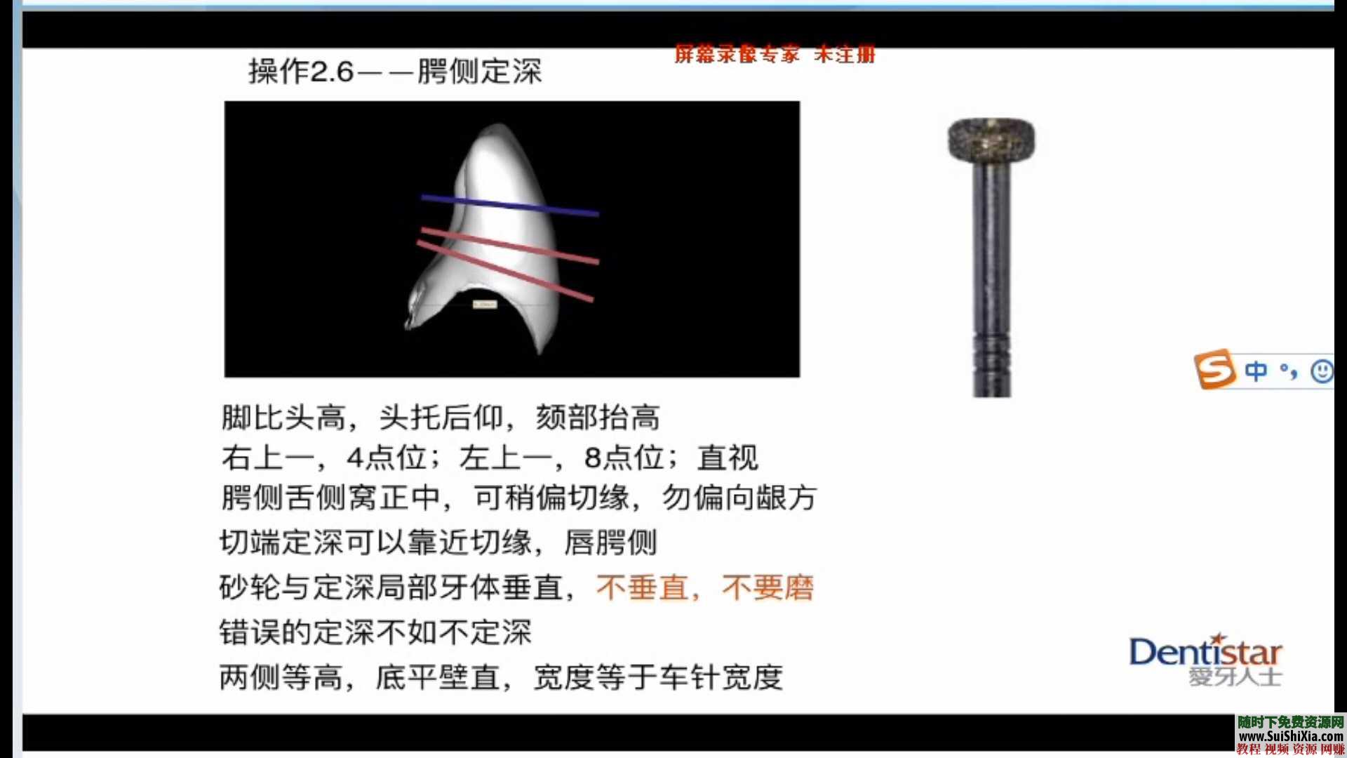 口腔大师 牙体预备牙实操系列课 印模全瓷根管等牙齿嵌体修复技术225G  共225G多套口腔大师牙体预备牙实操系列课+印模全瓷根管等牙齿嵌体修复技术 第8张